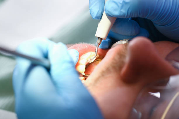 Best Weekend Emergency Dentist in Silver Lake, NC