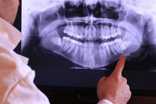 Best After-Hours Emergency Dentist in Silver Lake, NC